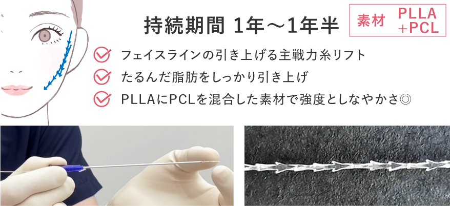 シークレットリフト解説