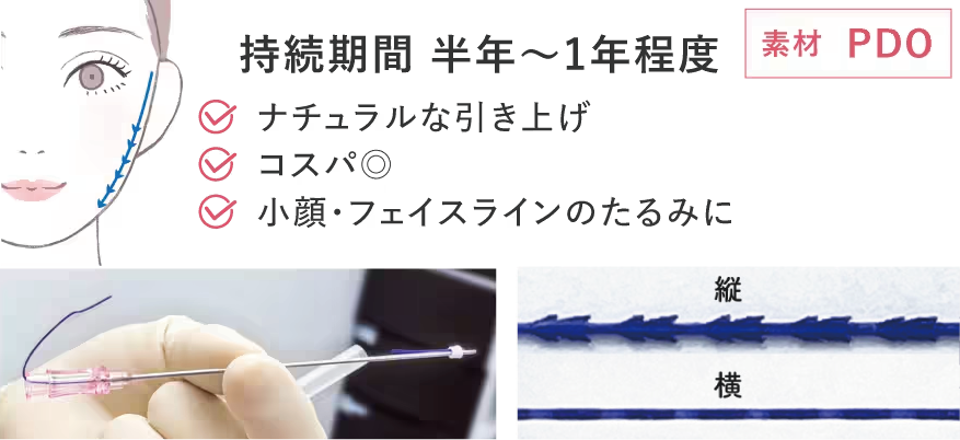 プリマリフト解説