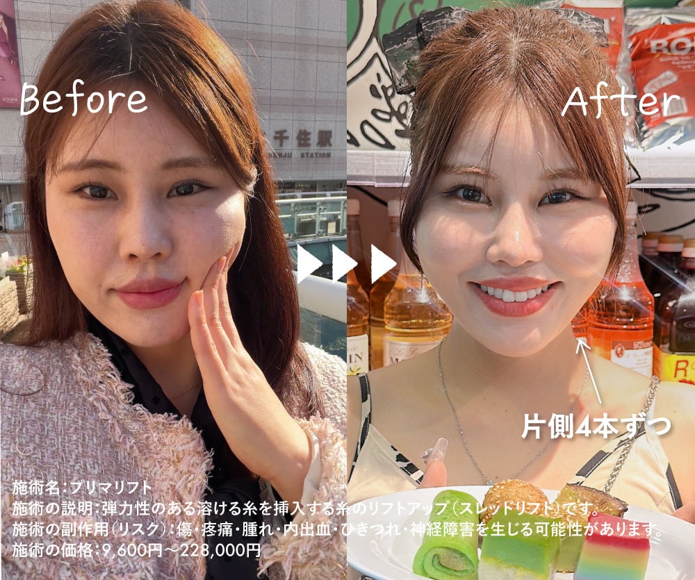 キャンペーン詳細