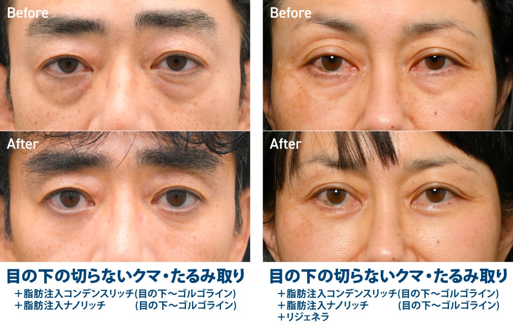 50代