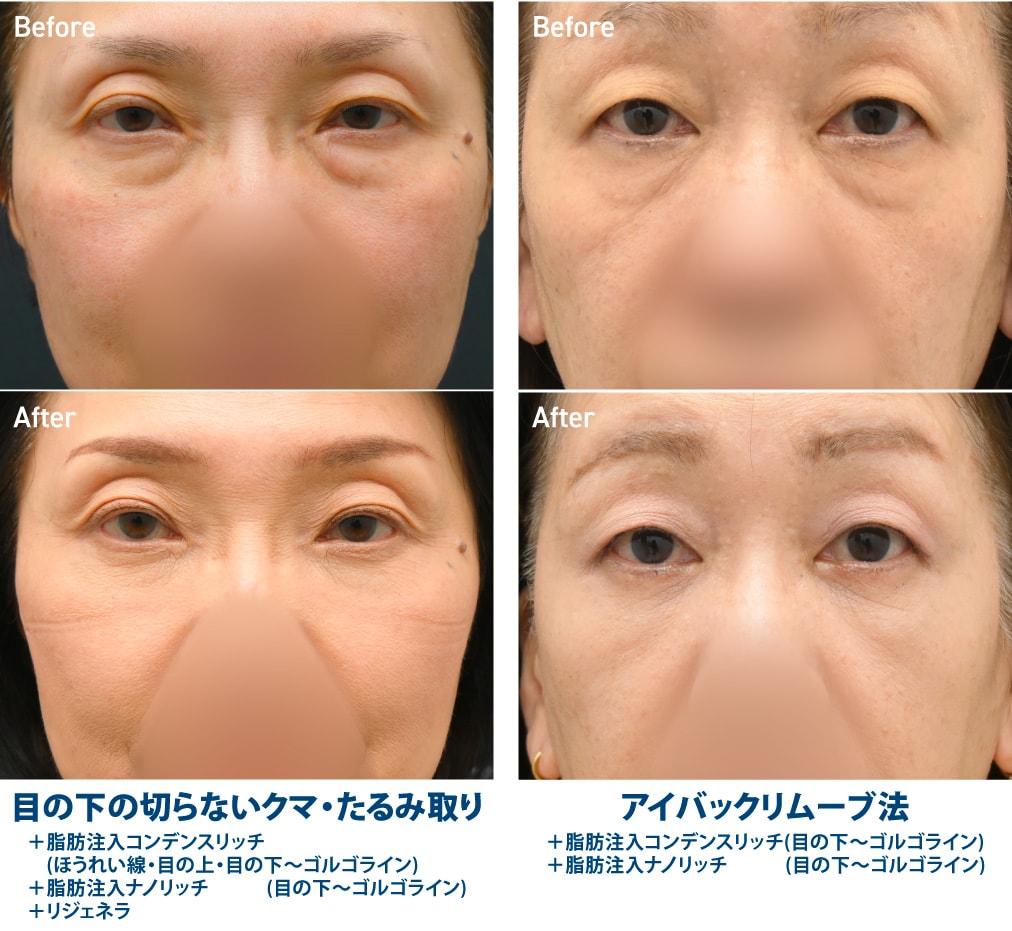 60代