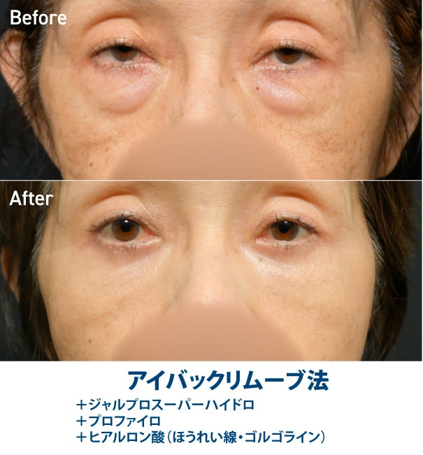70代