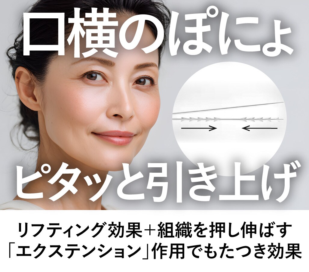 口横のもたつき・影をフラットに。次世代ショートスレッド「ぽにょぴたスレッド」【新規取り扱い開始】