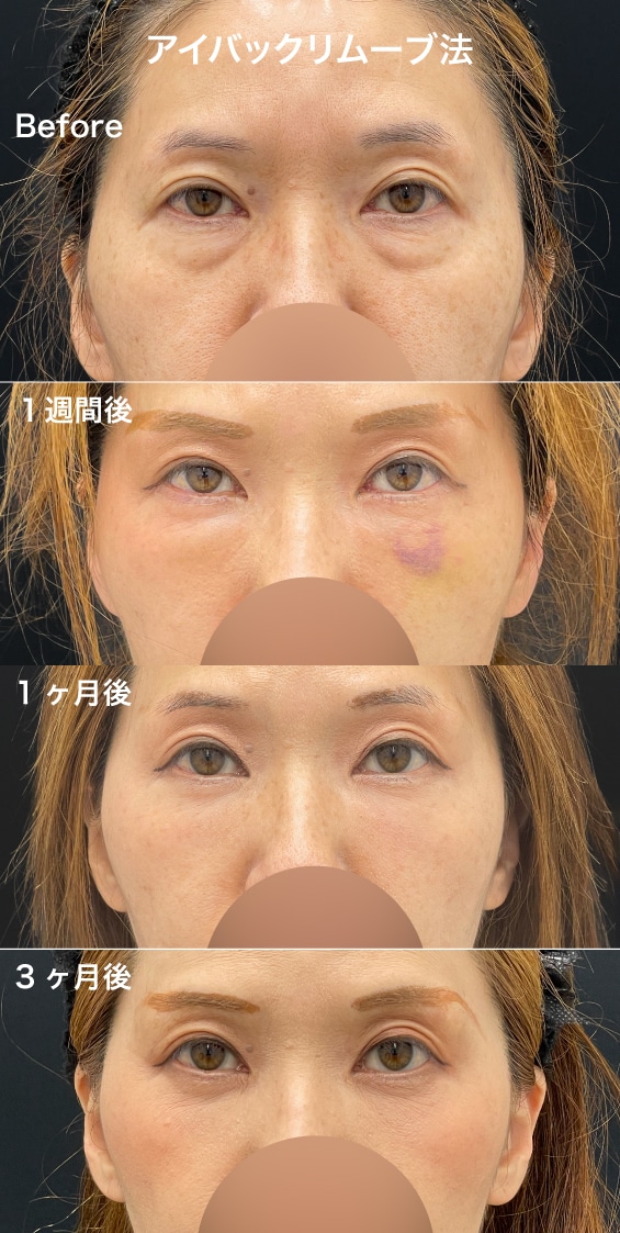 50代