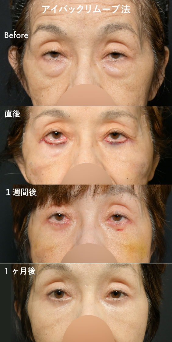 70代