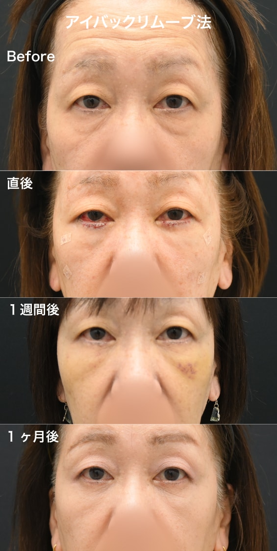 60代