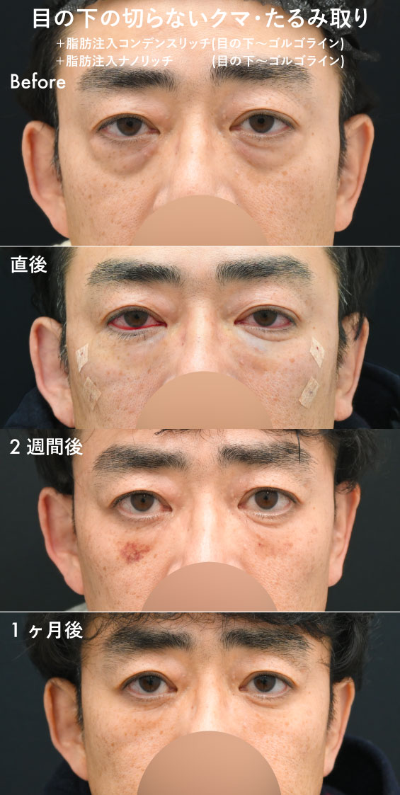 50代