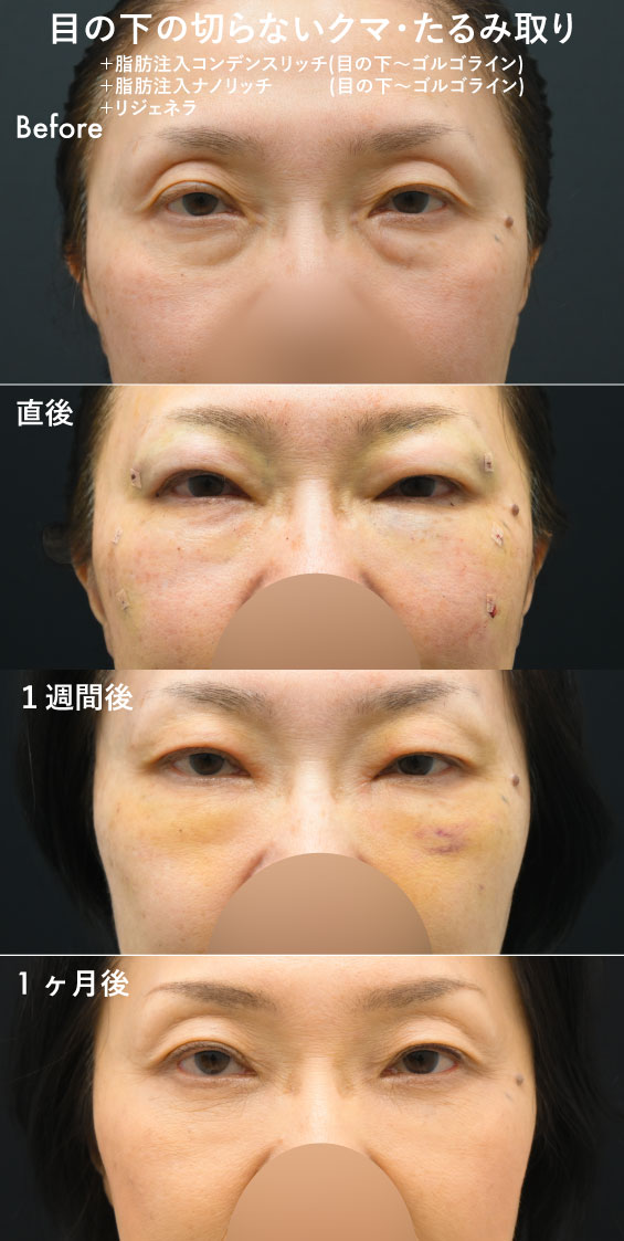 60代