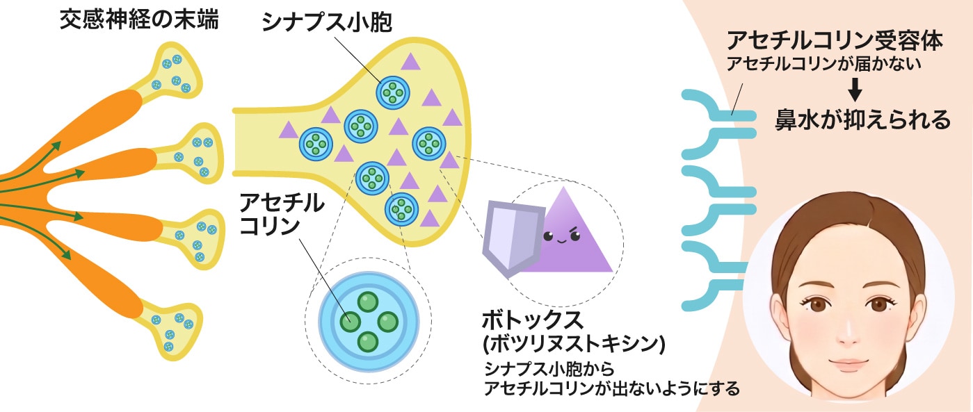 花粉症ボトックスのメカニズム