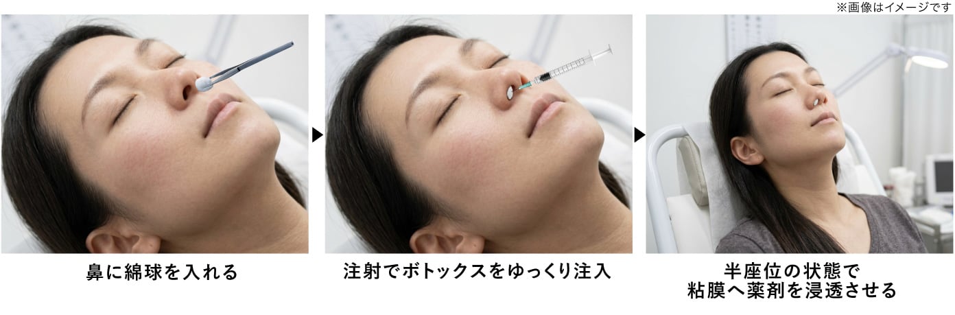 針を使わないから「痛みゼロ」