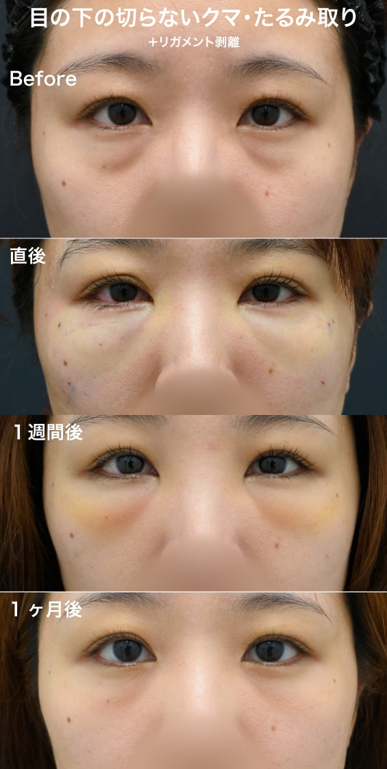 20代