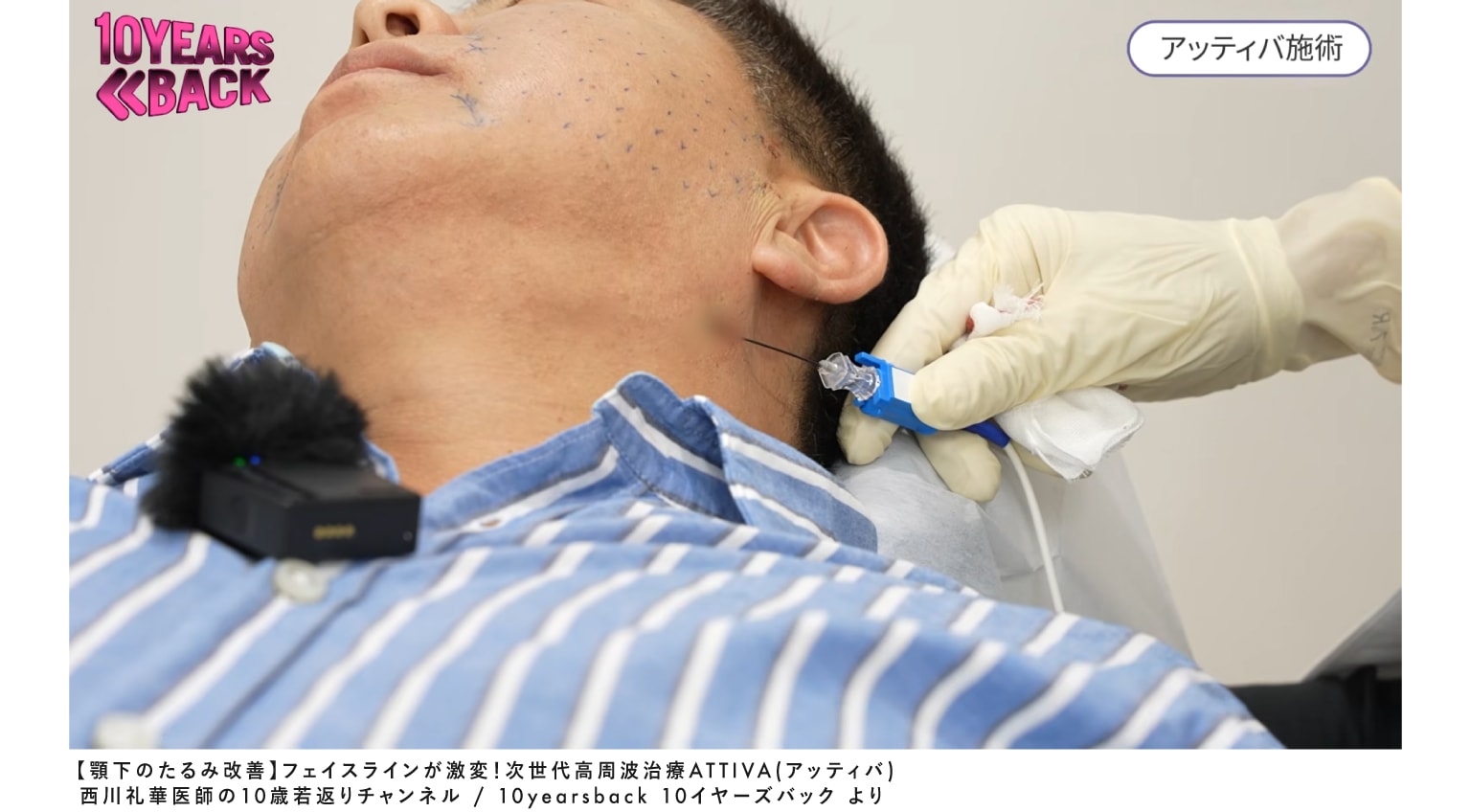 ピンポイントに狙える