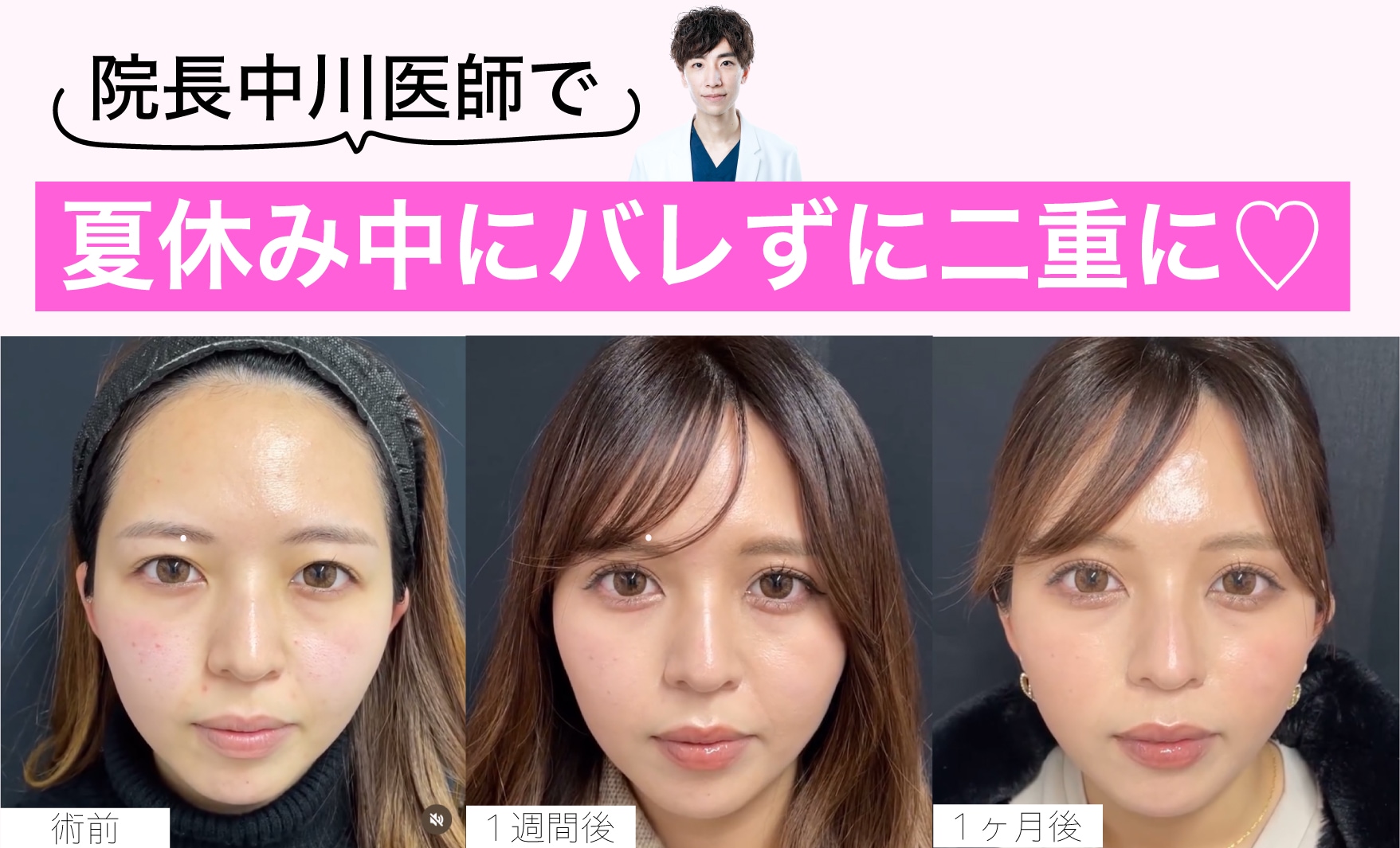 術直後からメイク可能💄