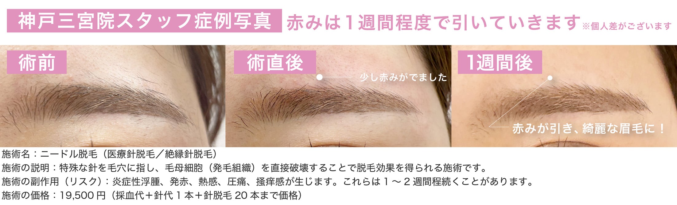 仕上がりが綺麗🌟