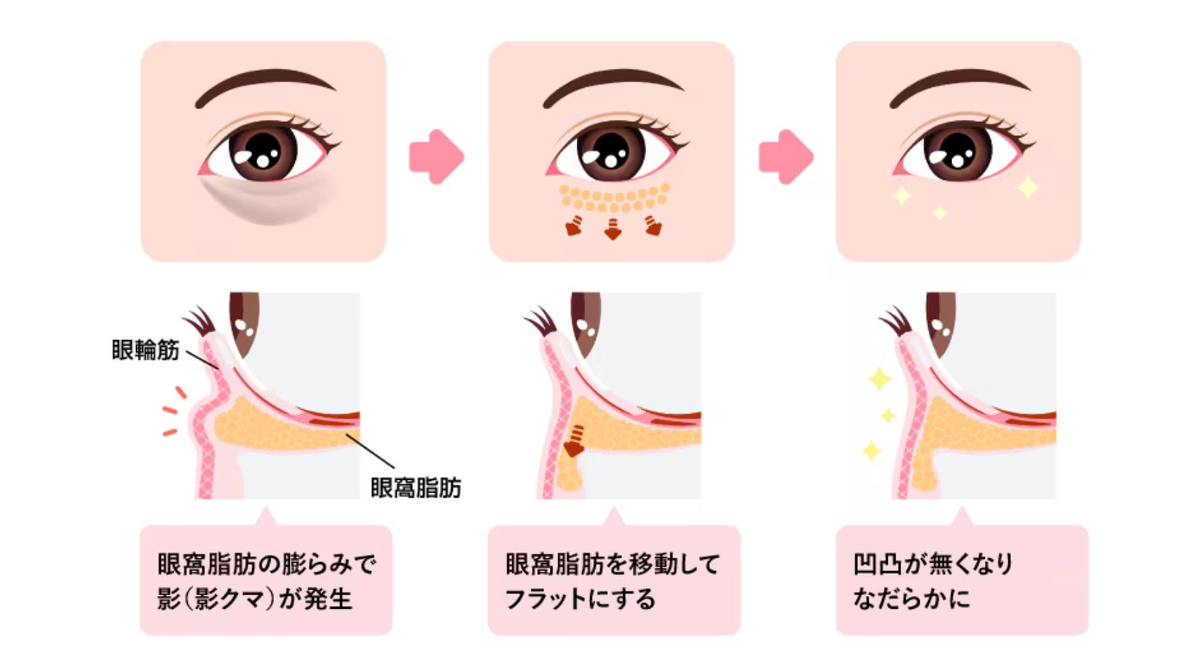中川医師こだわりの裏ハムラ