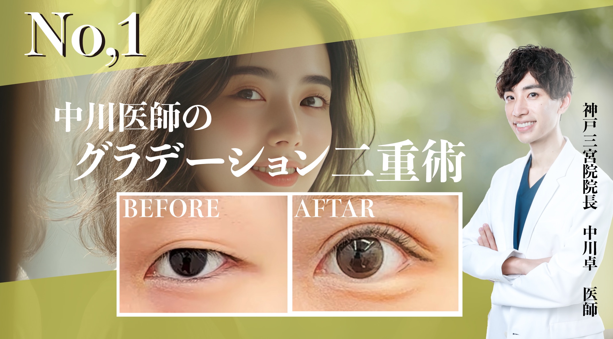 ナチュラルなのに印象的な目元に。初めての美容整形としても人気No.1!