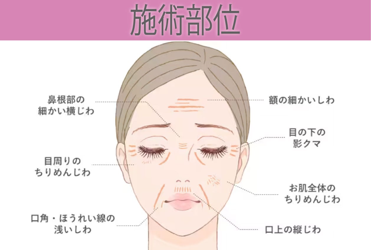 気になる部位へアプローチ！！