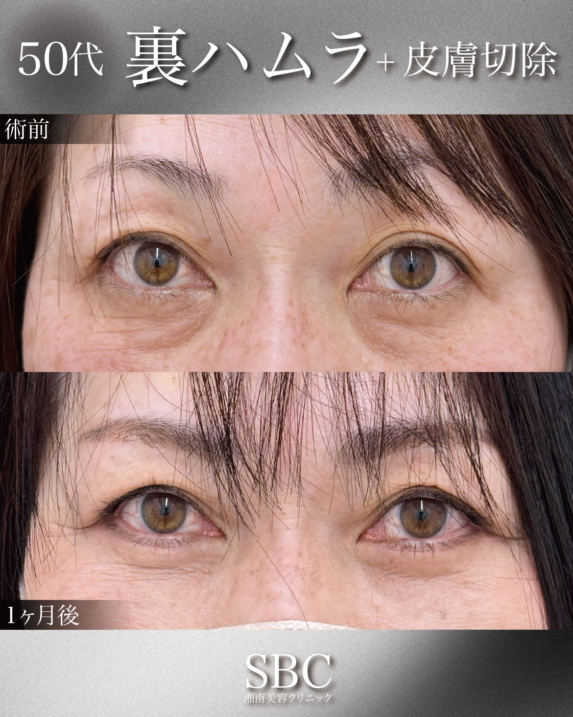 50代女性の症例解説