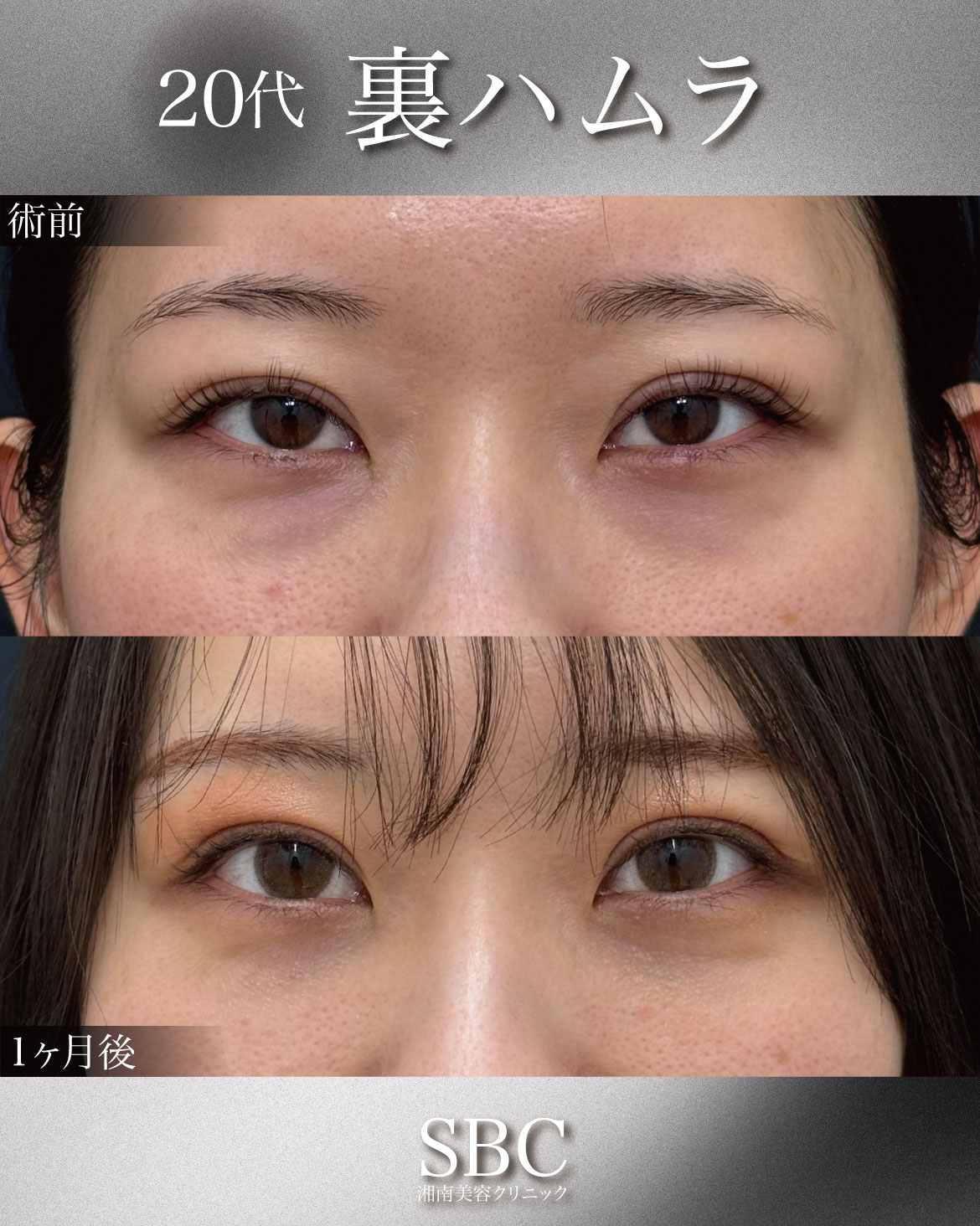 20代女性の症例解説