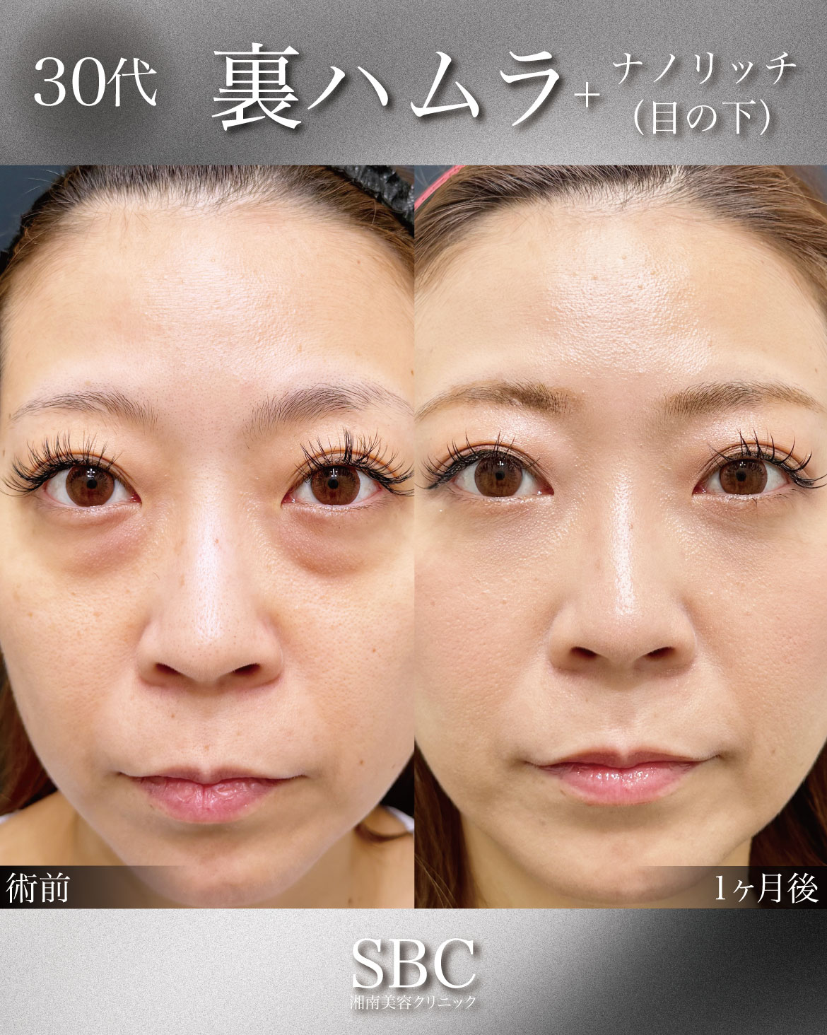 30代女性の症例解説