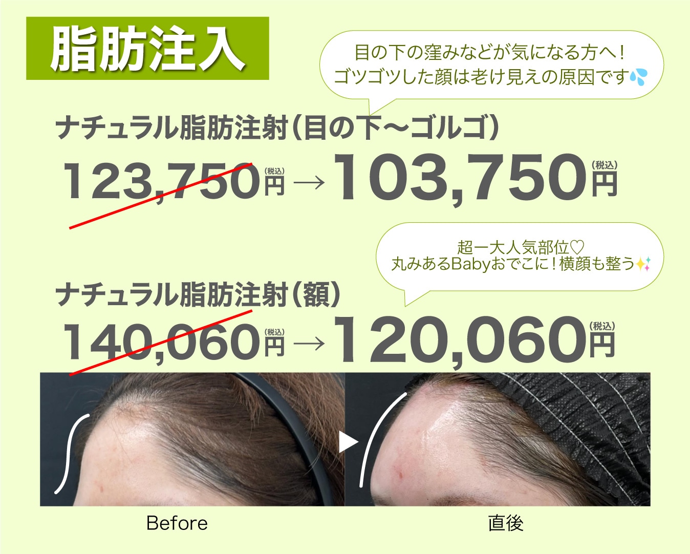 院長中川医師施術症例