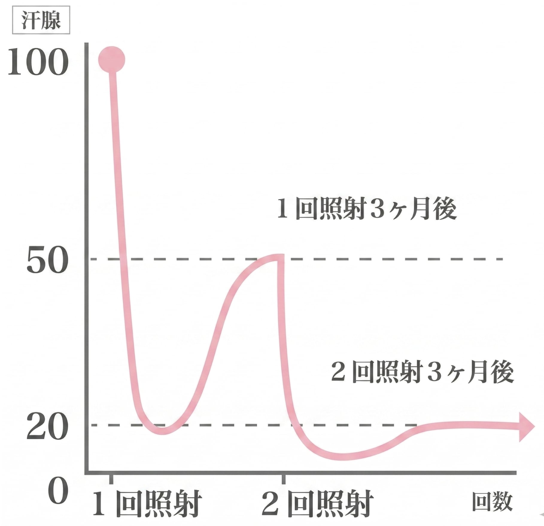 何回も照射するの？効果はいつから感じる？