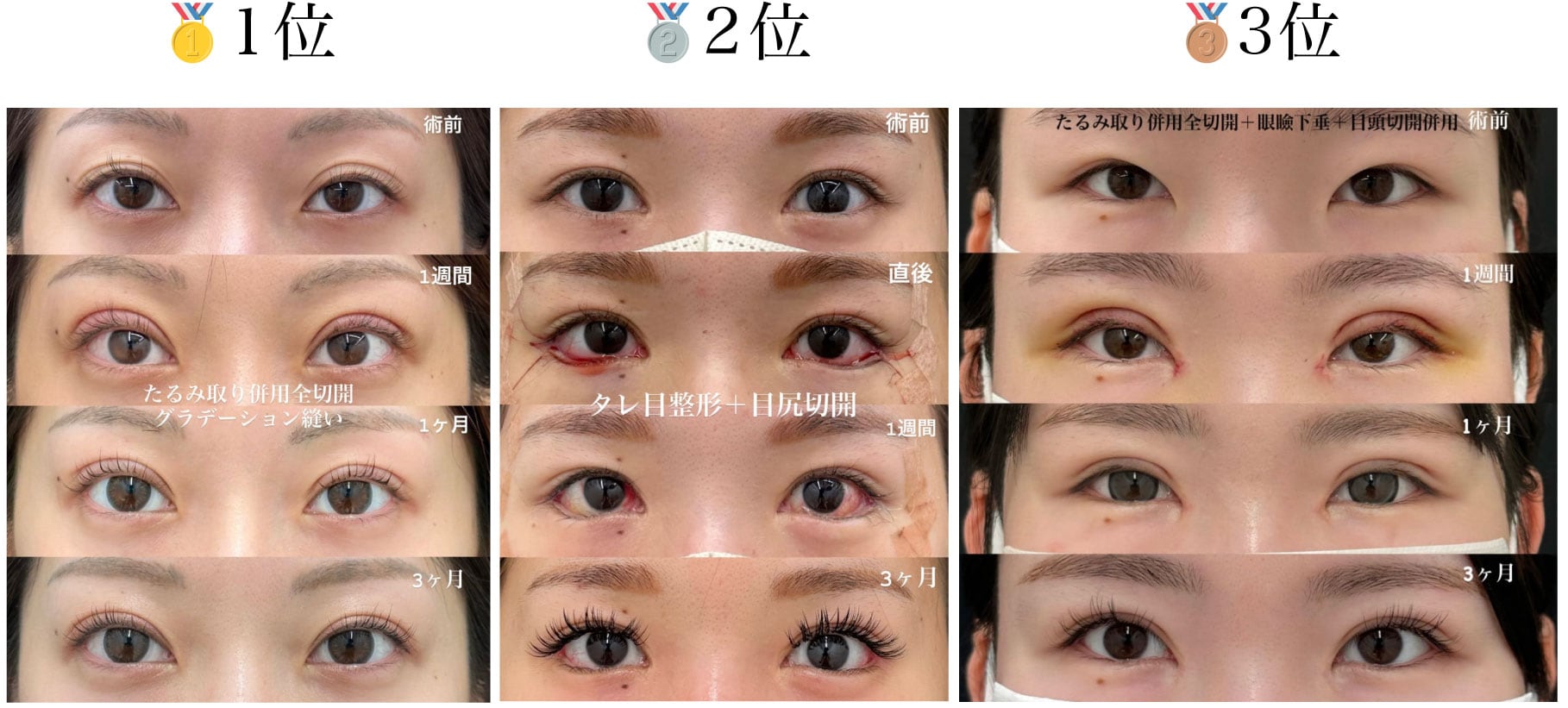 3月〜4月のBEST３位発表！