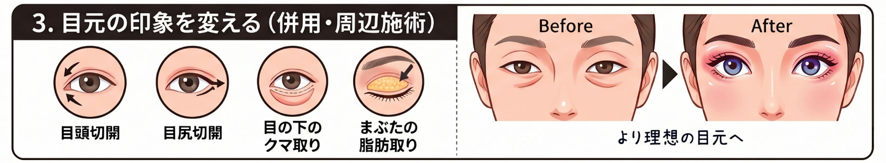 目元の印象を変える（併用・周辺施術）