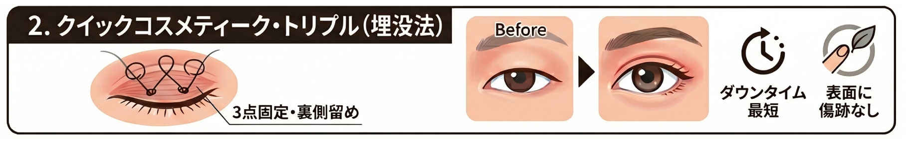 2位 クイックコスメティーク・トリプル