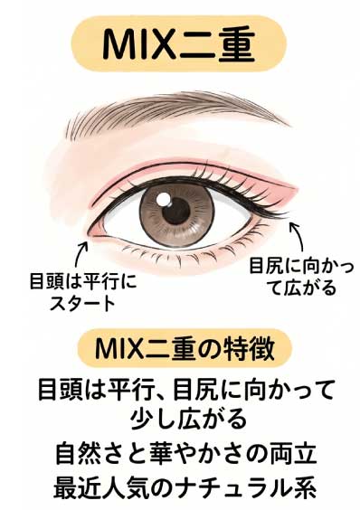 MIX二重
