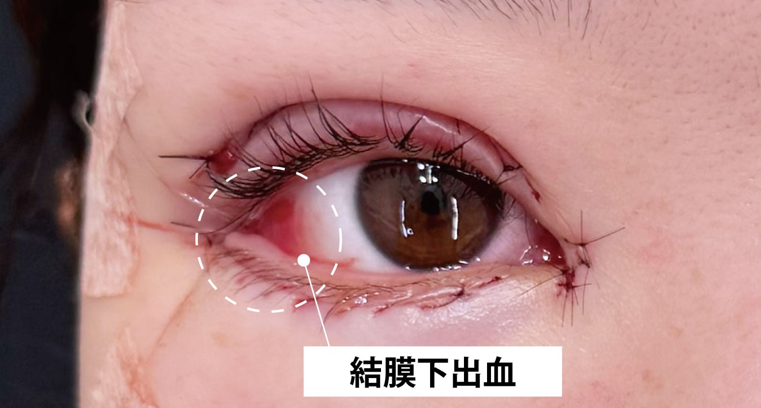 ③その他