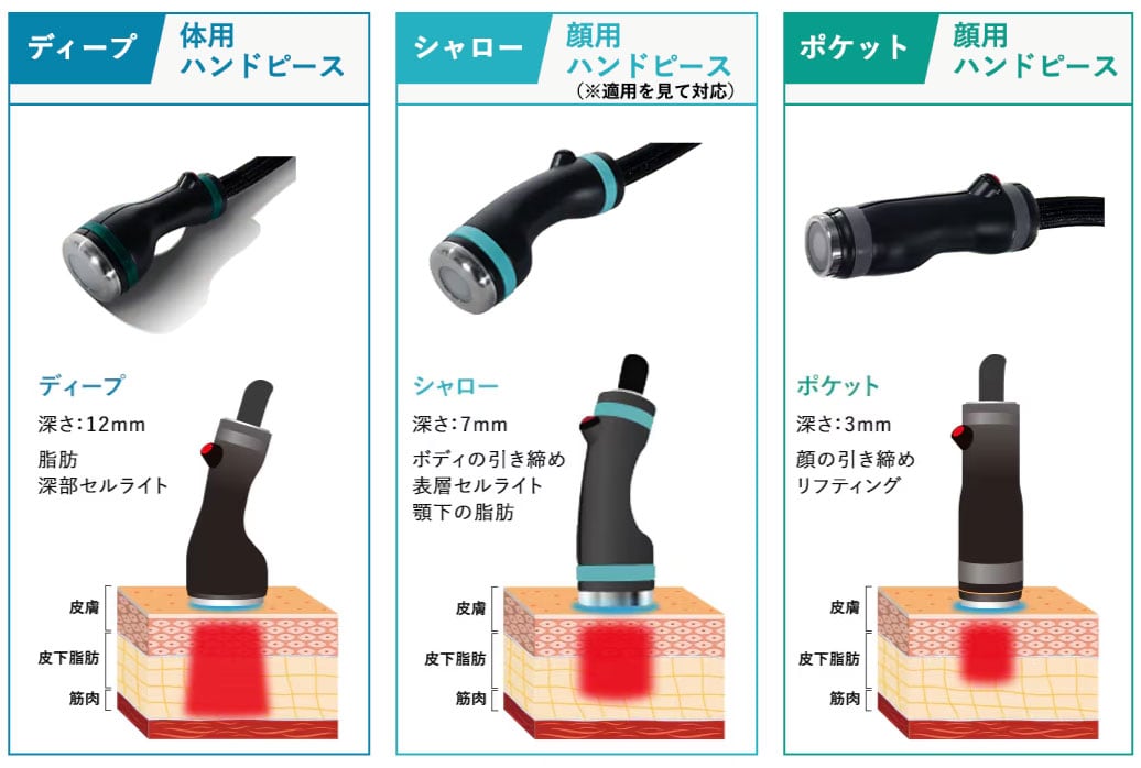 顔も体も照射可能！3種類のハンドピースで叶う「切らない脂肪溶解」