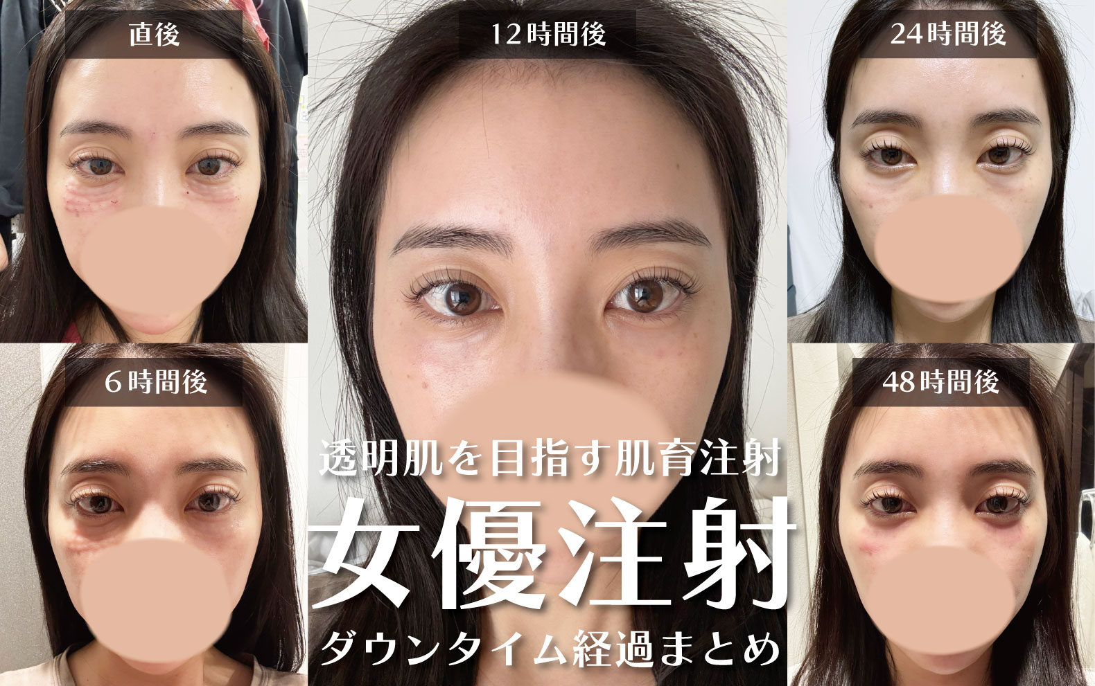 薄毛 女優