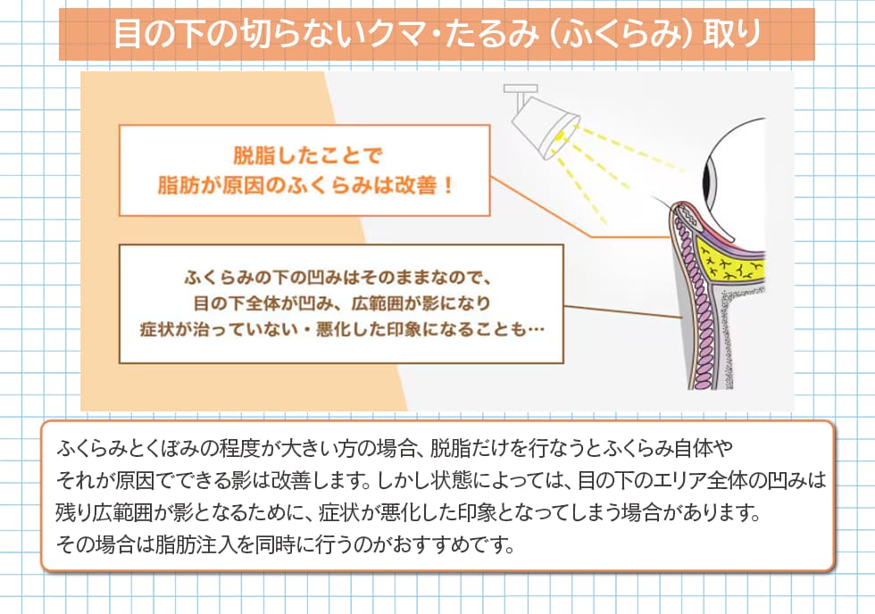 目の下の切らないクマ・たるみ(ふくらみ)取り