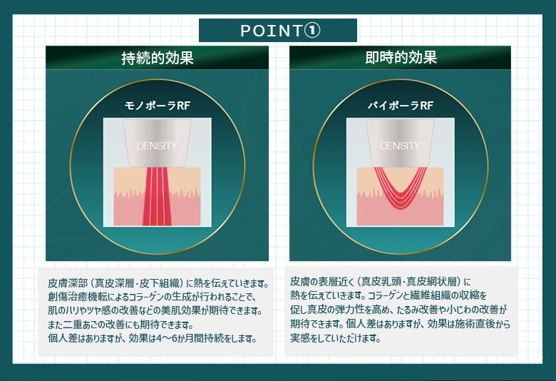 デンシティのおすすめポイント①