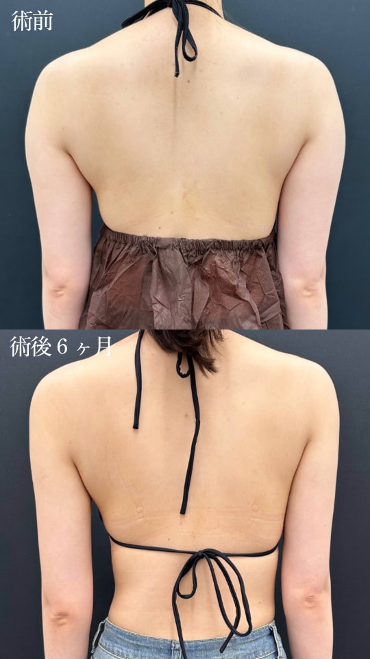 二の腕＋肩＋肩甲骨横