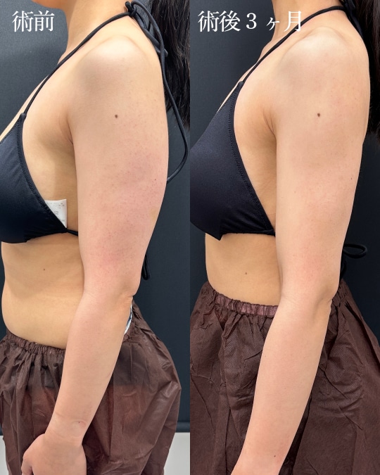 二の腕＋肩＋肩甲骨横