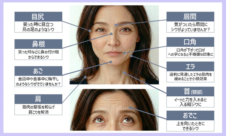 ボトックス人気部位