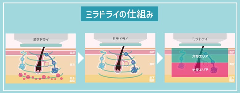 どういった治療？？