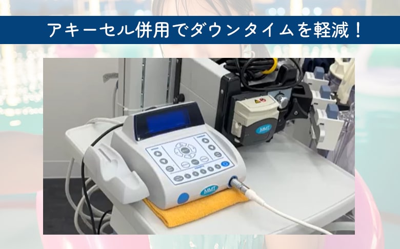 ダウンタイムを抑えたい方に!!