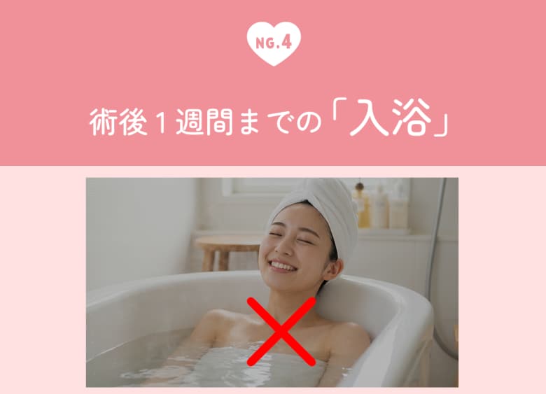 術後1週間までの「入浴」