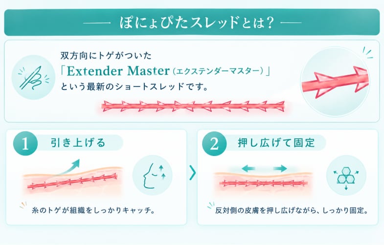 SBC最新のショートスレッド<br />
