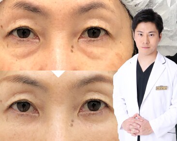 福岡・小倉でクマ取りをするなら岩間院長