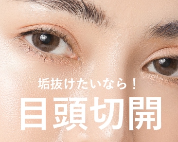 小倉院の目頭切開で一気に垢抜け！横幅がしっかりあるダイヤモンドEYEへ