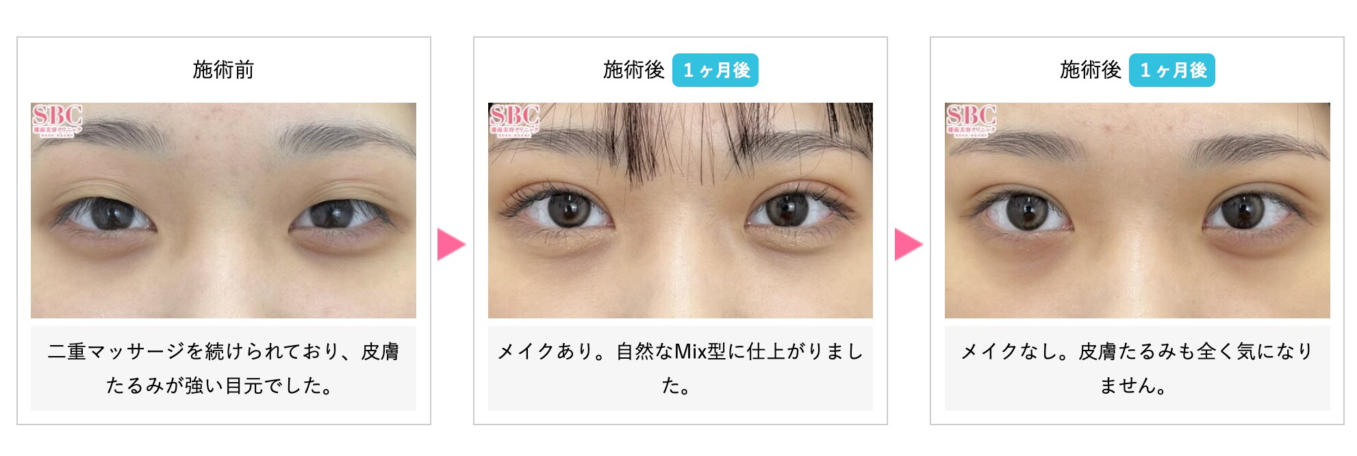 お知らせ】埋没の価格値下げ・院長が二重厳選ドクターに選ばれました 