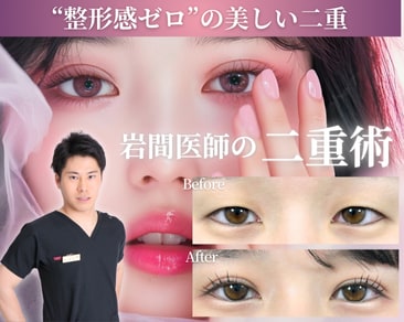 【二重埋没】福岡・小倉で人気の二重整形ならSBC小倉院の岩間医師がオススメ！