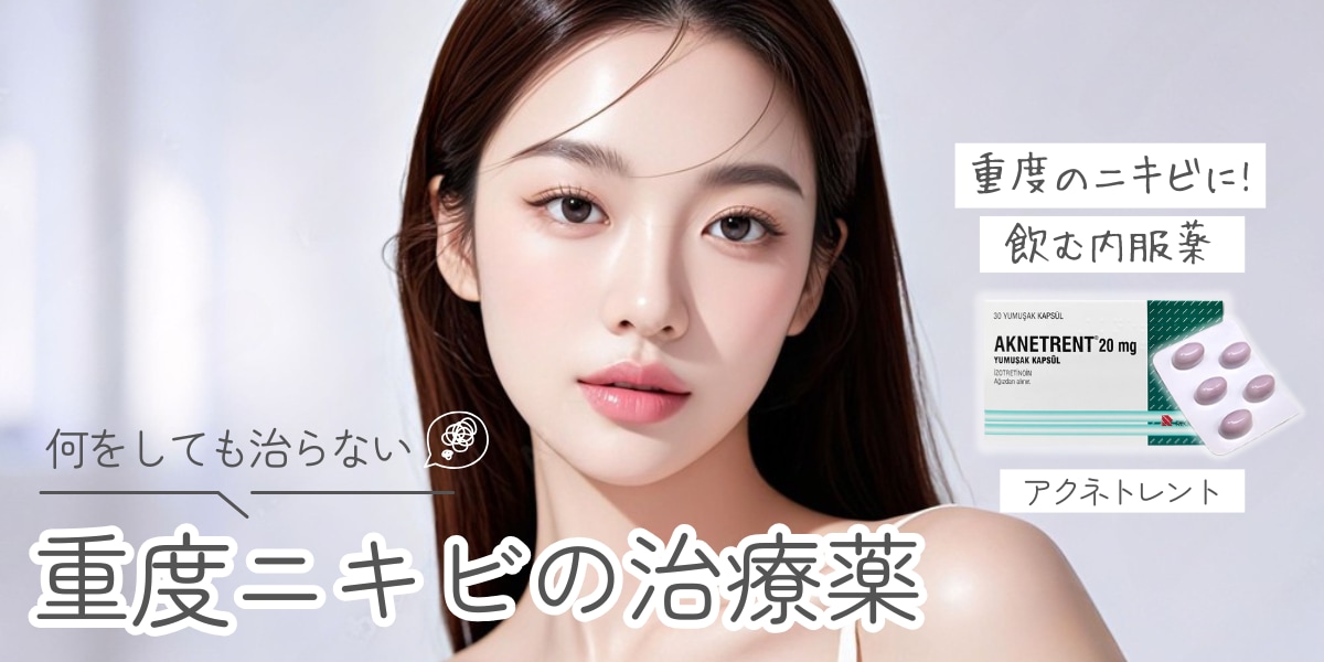 何をしても治らないニキビに悩んでいる人必見です