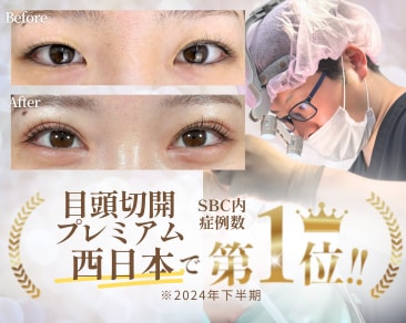 福岡の目頭切開は小倉院がおすすめなワケ！大きな瞳で目元の印象を変える！