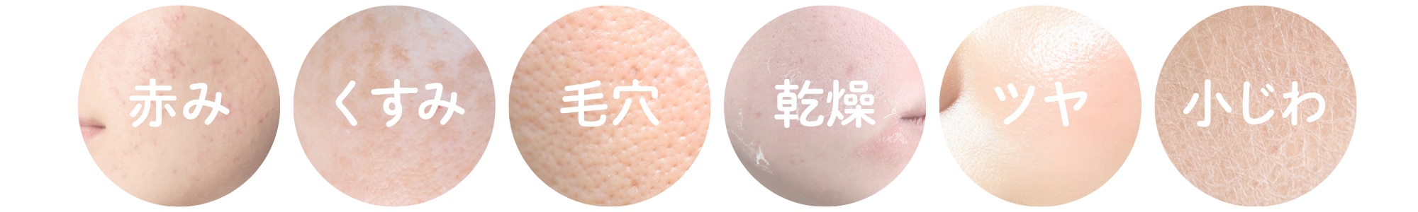 《悩みに合った施術を選べる》