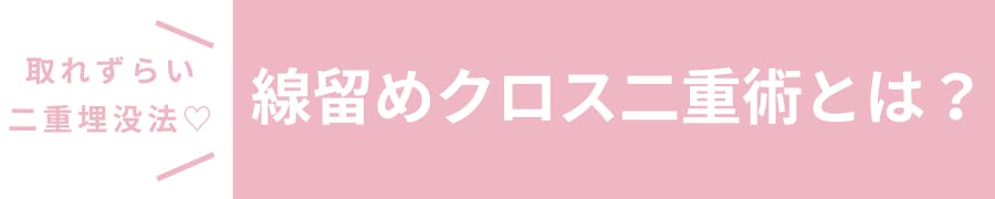しっかり固定して長持ちする二重「線留めクロス二重術」